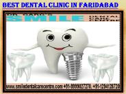 Best Dental Implant Clinic in Faridabad Area