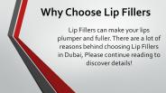 Why Choose Lip Fillers