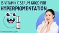 Is Vitamin C Serum Good for Hyperpigmentation PowerPoint PPT Presentation