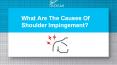 What Are The Causes Of Shoulder Impingement? PowerPoint PPT Presentation
