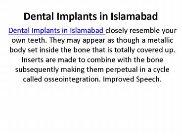 Dental Implants in Islamabad