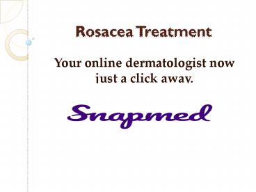 Rosacea Treatment PPT