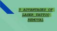 Top 5 Advantages of Laser Tattoo Removal PowerPoint PPT Presentation