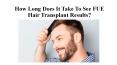 How Long Does It Take To See FUE Hair Transplant Results? PowerPoint PPT Presentation