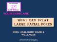 Aakar Skin Scientific - Treating Of Large Facial Pores PowerPoint PPT Presentation