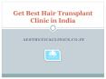 Get Best Hair Transplant Clinic in India PowerPoint PPT Presentation