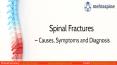Spinal Fractures – Causes, Symptoms and Diagnosis |Mehta Spine PowerPoint PPT Presentation
