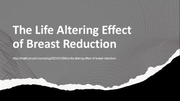 The Life Altering Effect of Breast Reduction