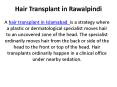 Hair Transplant in Rawalpindi PowerPoint PPT Presentation