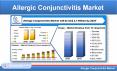 Allergic Conjunctivitis Market Share, Growth, Challenges, & Global Forecast PowerPoint PPT Presentation