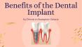 Benefits of the Dental Implant by Dentist in Brampton Ontario PowerPoint PPT Presentation