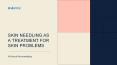 Skin Needling As a Treatment For Skin Problems PowerPoint PPT Presentation
