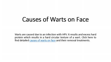 Causes of Warts on Face