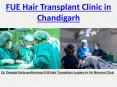 FUE Hair Transplant Clinic in Chandigarh PowerPoint PPT Presentation