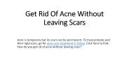Get Rid Of Acne Without Leaving Scars