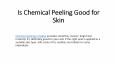 Is Chemical Peeling Good for Skin PowerPoint PPT Presentation
