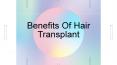 Benefits Of Hair Transplant PowerPoint PPT Presentation