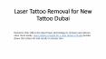 Laser Tattoo Removal for New Tattoo Dubai PowerPoint PPT Presentation