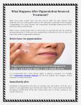 What Happens After Pigmentation Removal Treatment - Guide PowerPoint PPT Presentation