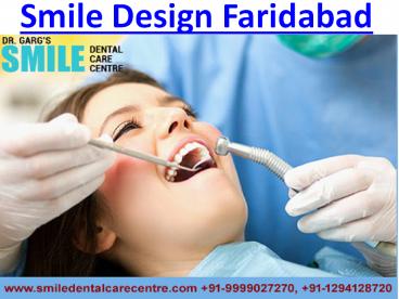 Best Dental Implant Clinic for Treatment in Faridabad