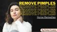 How to Remove Pimples Easy Home Remedies PowerPoint PPT Presentation