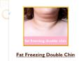 Facts To Know About Fat Freezing A Double Chin PowerPoint PPT Presentation