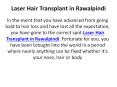 Laser Hair Transplant in Rawalpindi PowerPoint PPT Presentation