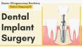 Dental Implant Surgery: What Is It? PowerPoint PPT Presentation