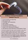 8 Most Common Problems Braces Can Fix PowerPoint PPT Presentation