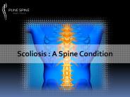 Scoliosis : A Spine Condition