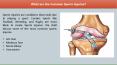 What are the Common Sports Injuries? PowerPoint PPT Presentation