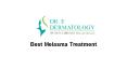 Best Melasma treatment in Vancouver bc PowerPoint PPT Presentation