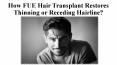 How FUE Hair Transplant Restores Thinning or Receding Hairline? PowerPoint PPT Presentation
