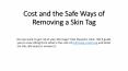 Cost and the Safe Ways of Removing a Skin Tag PowerPoint PPT Presentation