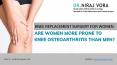 Knee Replacement Surgery for Women: Are Women More Prone to Knee Osteoarthritis than Men? PowerPoint PPT Presentation