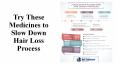Try These Medicines to Slow Down Hair Loss Process PowerPoint PPT Presentation