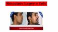Rhinoplasty Surgery in Delhi PowerPoint PPT Presentation