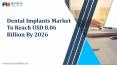 Dental Implants Market Production Cost, Market Growth And Forecasts To 2028