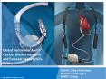 Ventricular Assist Devices Market Report in PPT: Top Companies, Trends and Future Details for Business Opportunity PowerPoint PPT Presentation