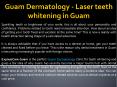 Guam Dermatology - Laser teeth whitening in Guam PowerPoint PPT Presentation