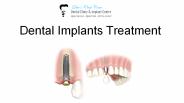 Dental Implants in Pune| Dev's Oral Care (1)