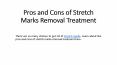 Pros and Cons of Stretch Marks Removal Treatment PowerPoint PPT Presentation
