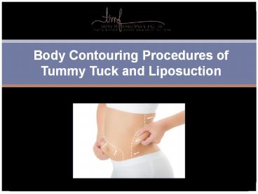 Body Contouring Procedures of Tummy Tuck and Liposuction