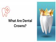 What Are Dental Crown