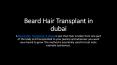 Beard Hair Transplant in dubai PowerPoint PPT Presentation