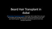 Beard Hair Transplant in dubai