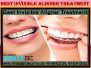 Best Invisible Aligner Treatment and Orthodontists