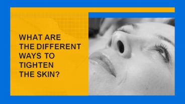 Skin Tightening: 5 Things You Need To Know