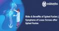 Symptoms of Loose Screws after Spinal Fusion | Orthopaedics and Spine specialist in UK PowerPoint PPT Presentation