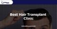 Choose best hair transplant clinic at Outbloom Clinics PowerPoint PPT Presentation